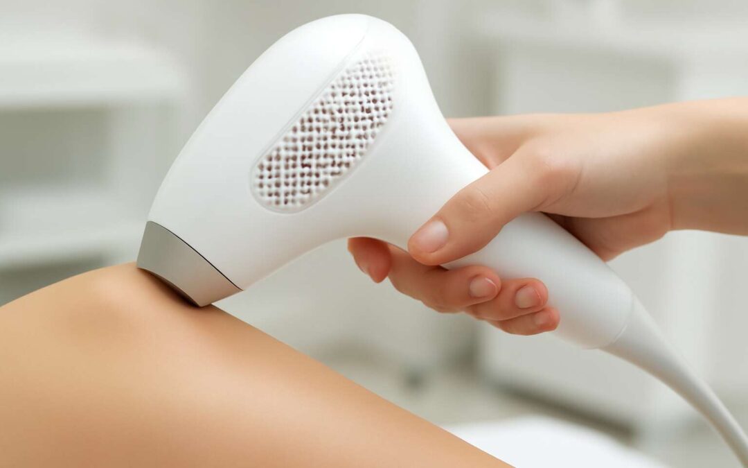 Is Laser Hair Removal Permanent or Temporary? Find Out the Truth Behind Long-Lasting Results