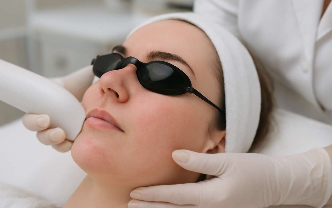 laser hair removal and rosacea: what you need to know for safe results.